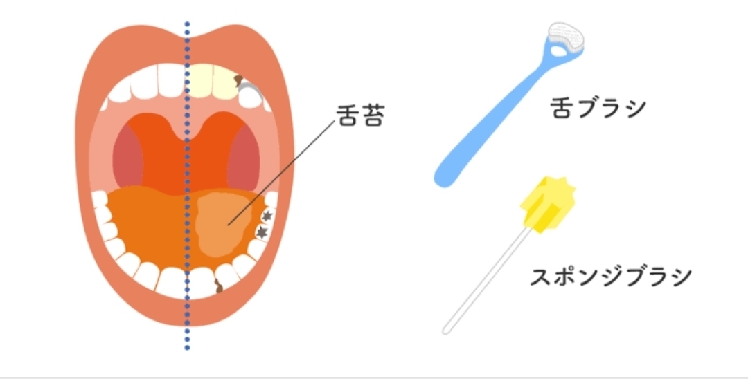 舌ブラシ